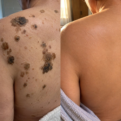Terre Glycolic Body Stick