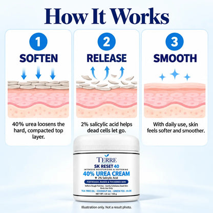 Terre SK Reset 40 — 40% Urea Cream with 2% Salicylic Acid